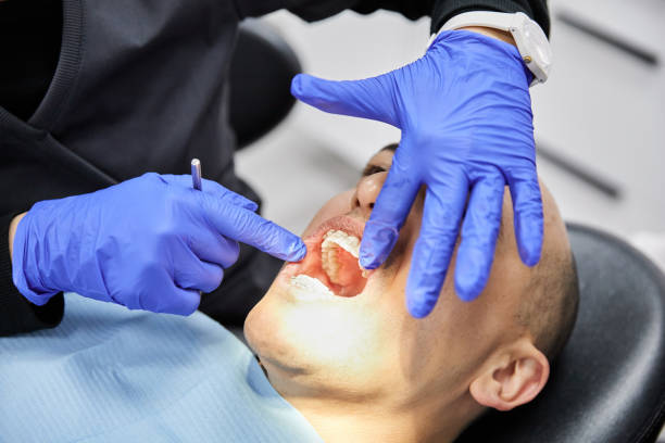 Best Emergency Dentist for Lost Fillings or Crowns in White Center, WA